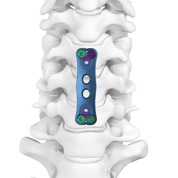 Placca della colonna vertebrale cervicale anteriore Ⅰ