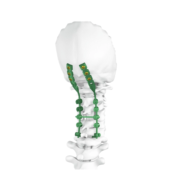 Sistema di vite della colonna vertebrale occipitocervicale posteriore
