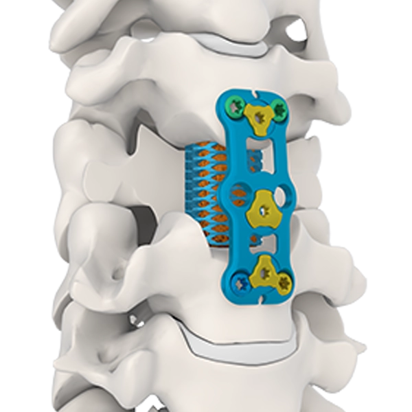 Placca della colonna vertebrale cervicale anteriore Ⅳ